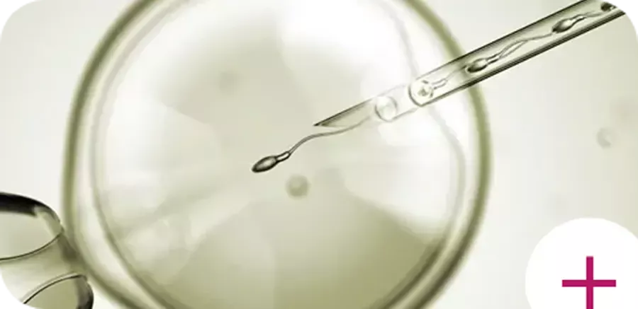 IVF / ICSI